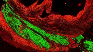 Murry Lab/University of Washington Implante de células cardíacas derivadas de células madre humanas (verde) infiltradas y bombeando al mismo tiempo que las células del corazón de los primates (rojo)